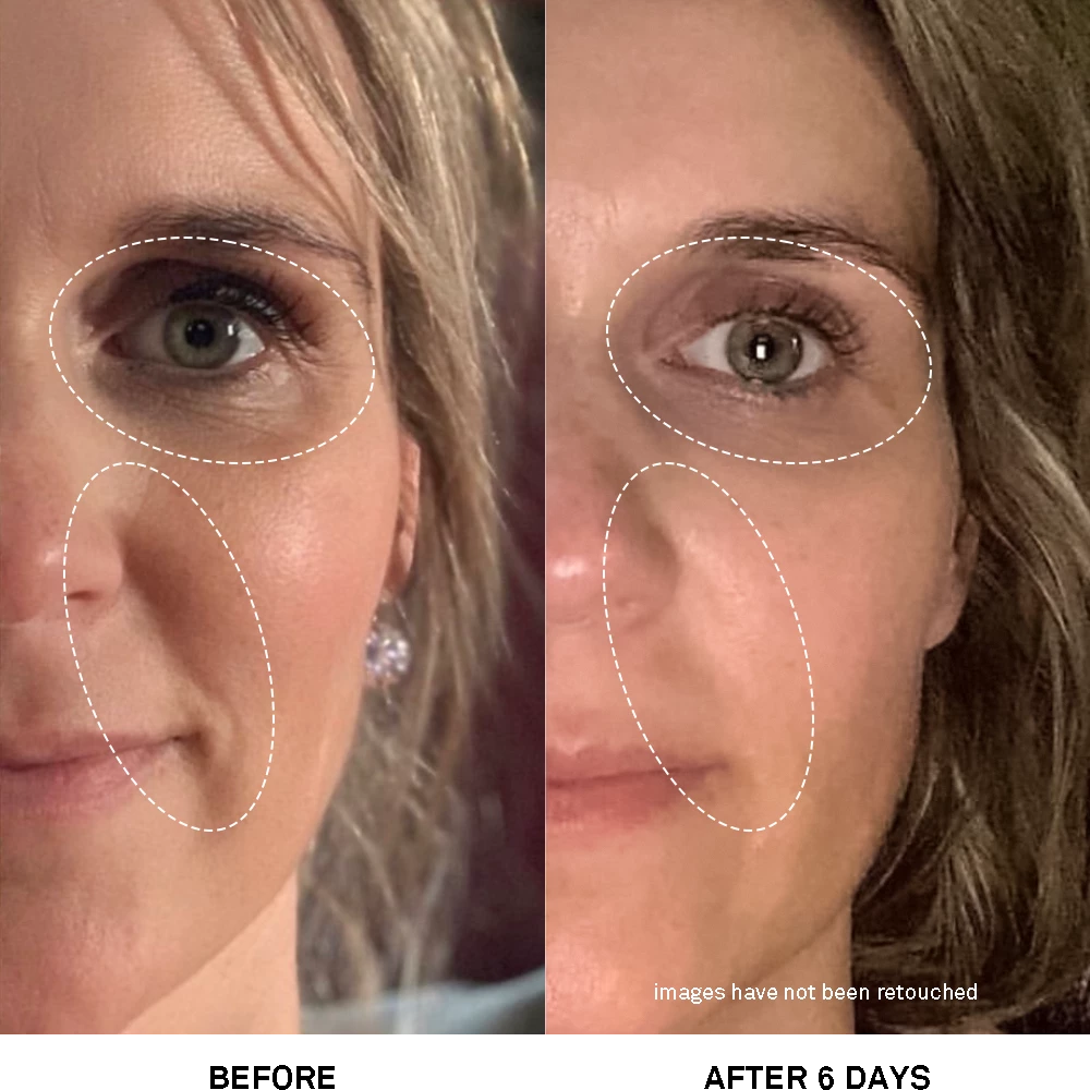 05 Advanced Rejuvenating Power Treatment