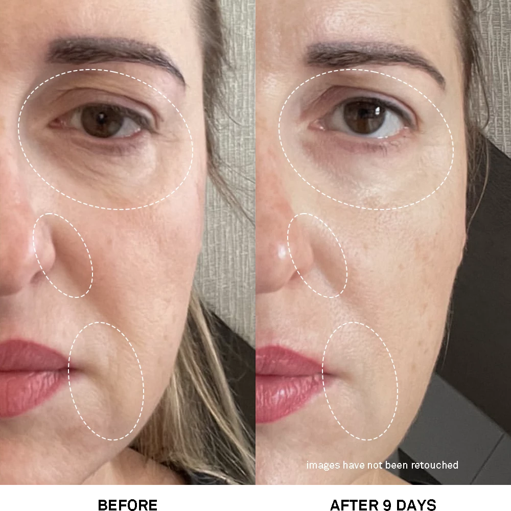 05 Advanced Rejuvenating Power Treatment
